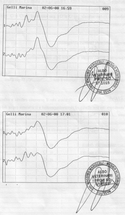 audiometria